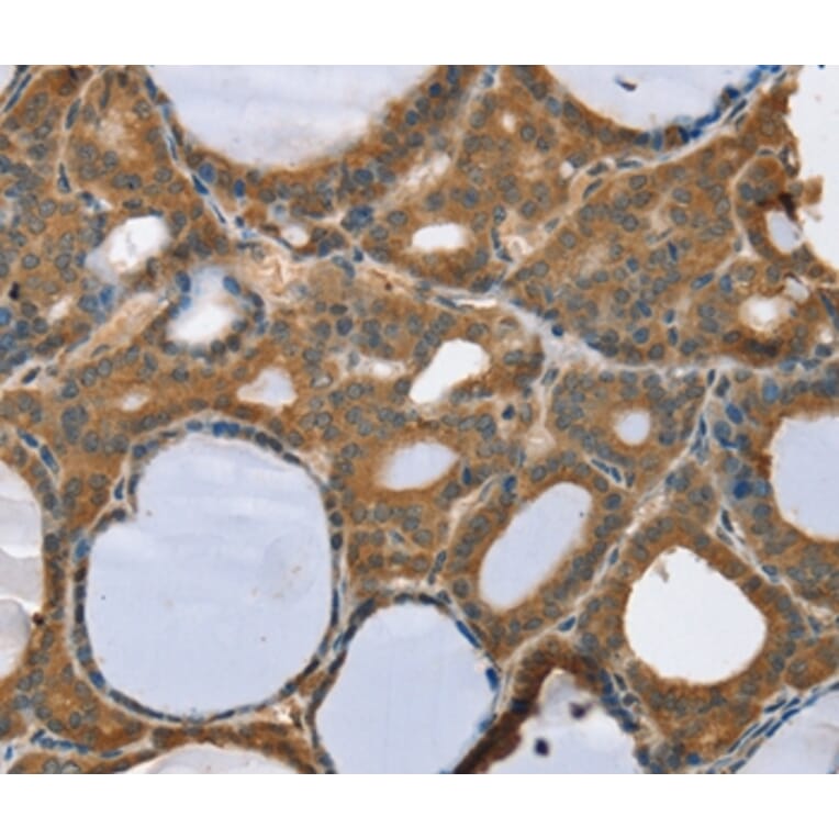 Immunohistochemistry - TRIM3 Antibody from Signalway Antibody (37876) - Antibodies.com