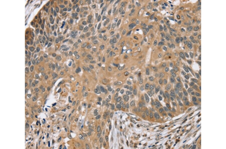 Immunohistochemistry - TRIM3 Antibody from Signalway Antibody (37876) - Antibodies.com