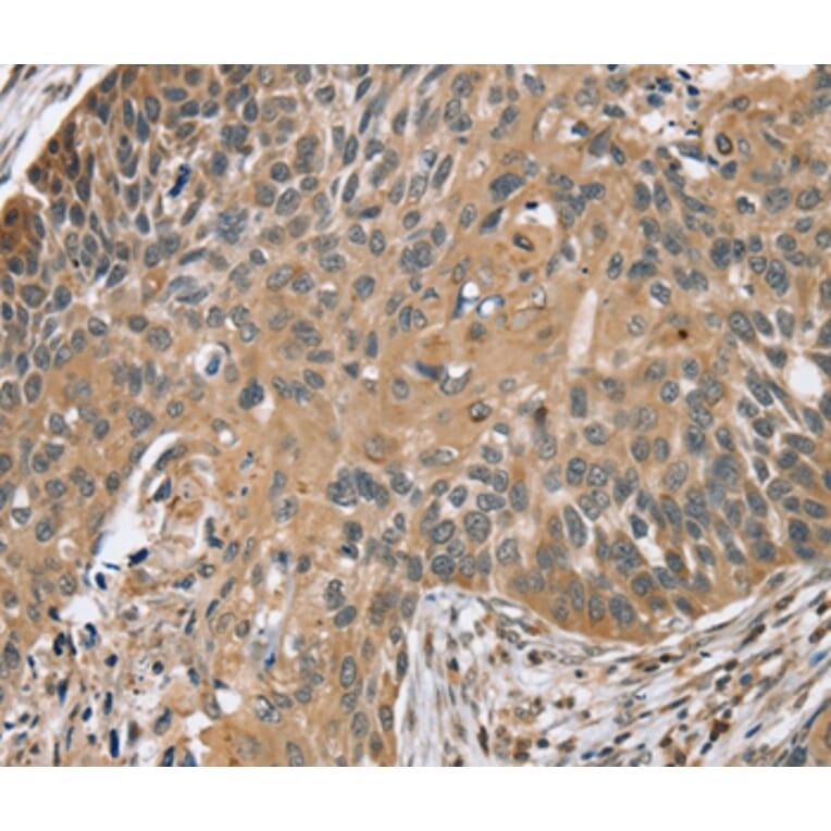 Immunohistochemistry - TRIM3 Antibody from Signalway Antibody (37876) - Antibodies.com