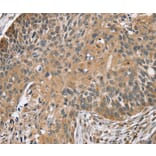 Immunohistochemistry - TRIM3 Antibody from Signalway Antibody (37876) - Antibodies.com