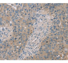 Immunohistochemistry - ROBO2 Antibody from Signalway Antibody (37879) - Antibodies.com