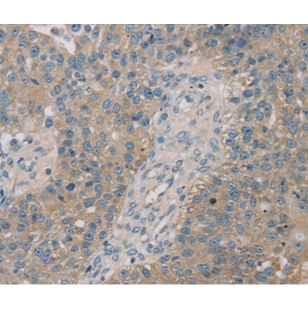 Immunohistochemistry - ROBO2 Antibody from Signalway Antibody (37879) - Antibodies.com