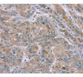 Immunohistochemistry - SAMD9 Antibody from Signalway Antibody (37891) - Antibodies.com