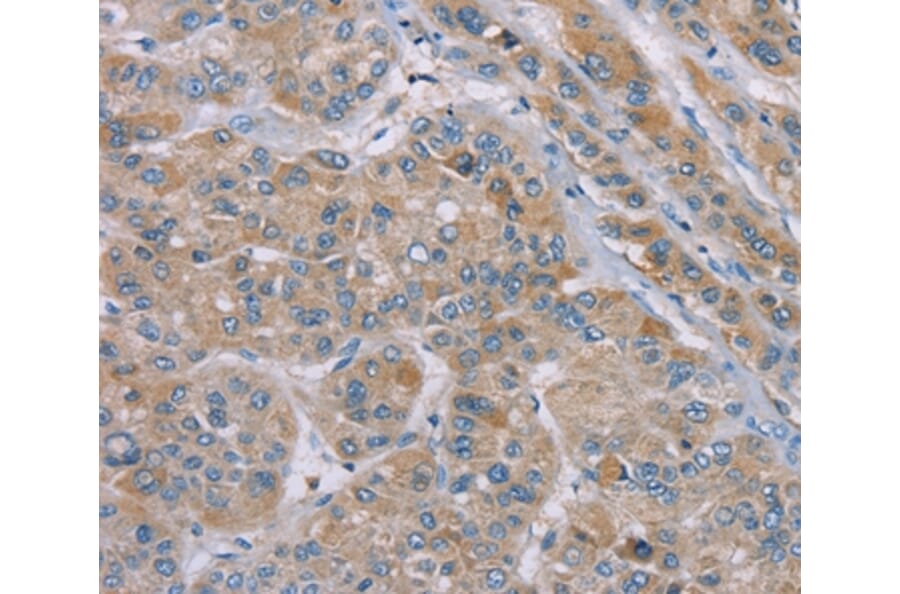 Immunohistochemistry - SAMD9 Antibody from Signalway Antibody (37891) - Antibodies.com