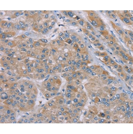 Immunohistochemistry - SAMD9 Antibody from Signalway Antibody (37891) - Antibodies.com