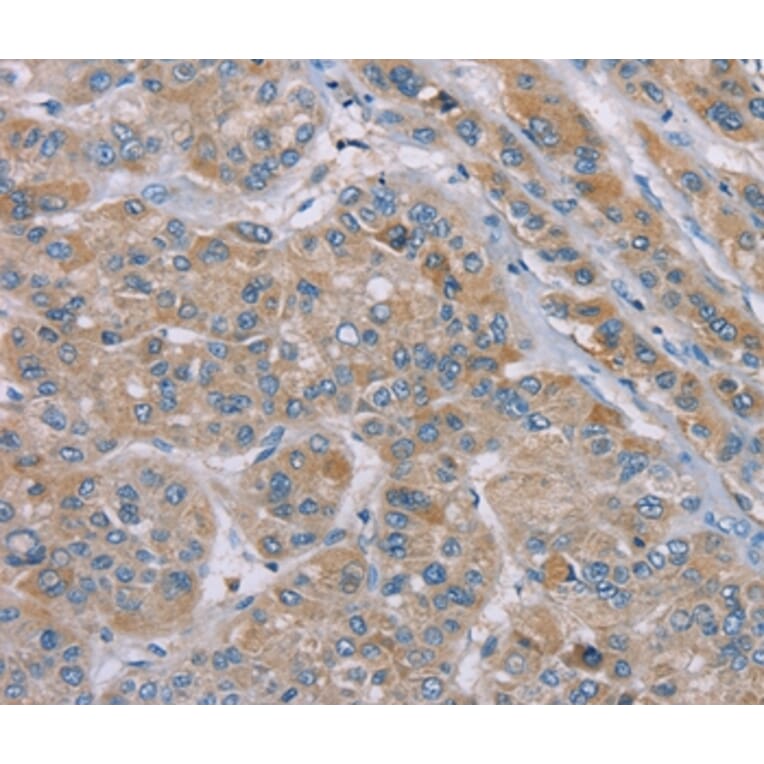 Immunohistochemistry - SAMD9 Antibody from Signalway Antibody (37891) - Antibodies.com