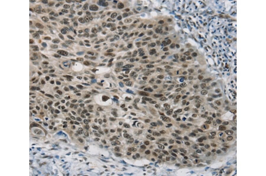 Immunohistochemistry - SART3 Antibody from Signalway Antibody (37894) - Antibodies.com
