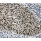 Immunohistochemistry - SART3 Antibody from Signalway Antibody (37894) - Antibodies.com