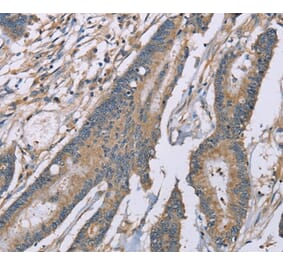 Immunohistochemistry - SASH1 Antibody from Signalway Antibody (37895) - Antibodies.com