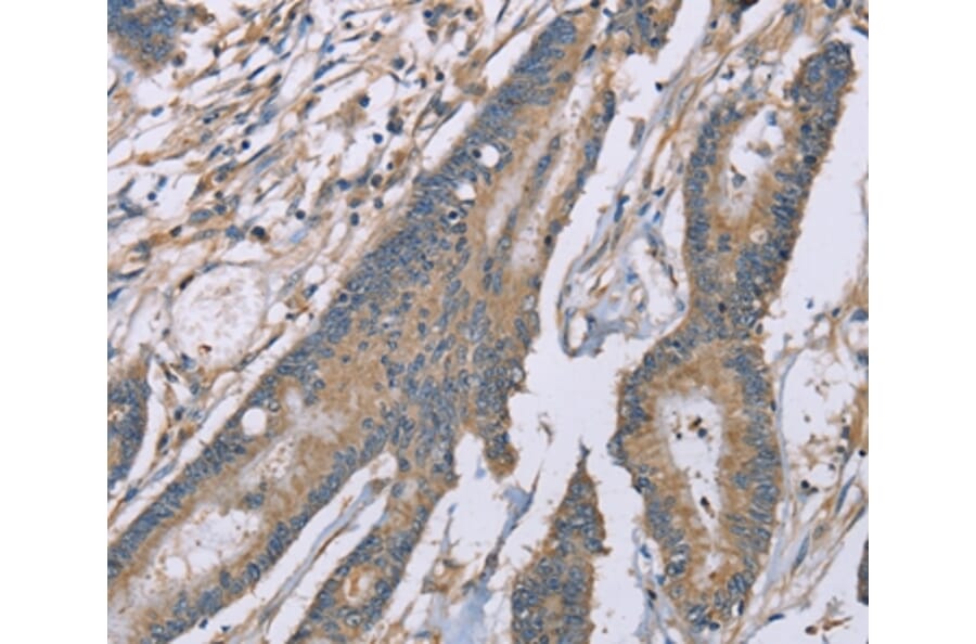 Immunohistochemistry - SASH1 Antibody from Signalway Antibody (37895) - Antibodies.com