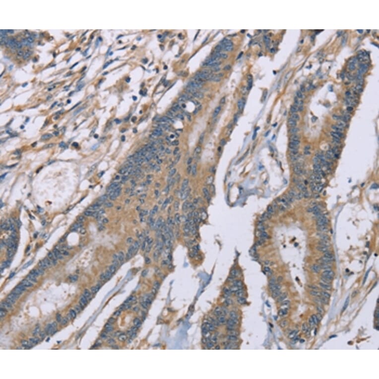 Immunohistochemistry - SASH1 Antibody from Signalway Antibody (37895) - Antibodies.com
