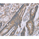 Immunohistochemistry - SASH1 Antibody from Signalway Antibody (37895) - Antibodies.com
