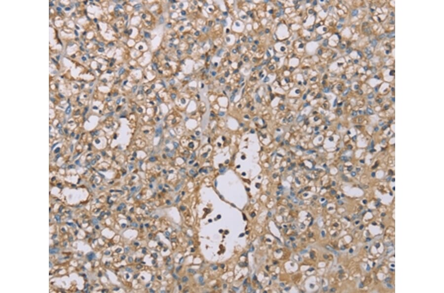 Immunohistochemistry - SCN1B Antibody from Signalway Antibody (37898) - Antibodies.com