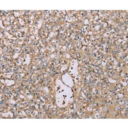 Immunohistochemistry - SCN1B Antibody from Signalway Antibody (37898) - Antibodies.com