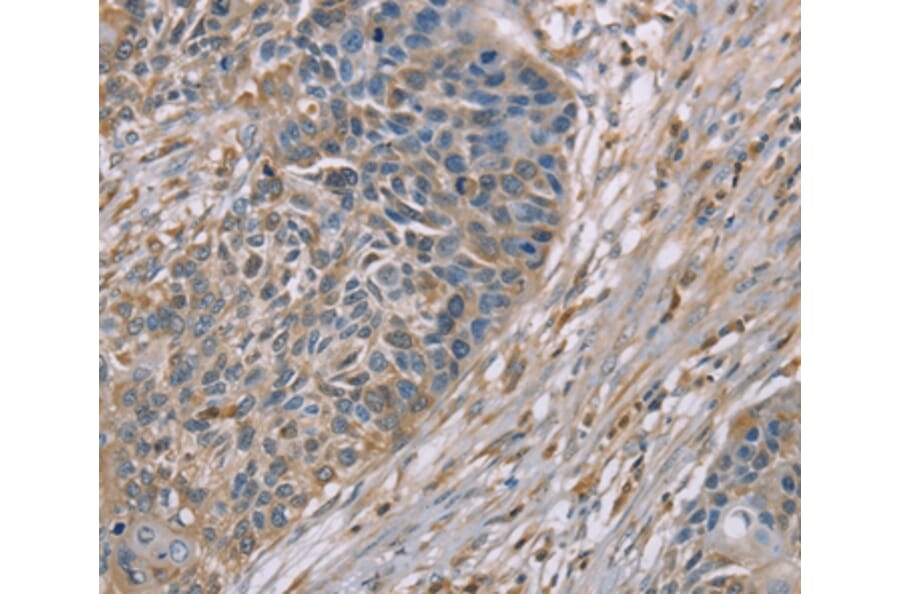 Immunohistochemistry - SCN1B Antibody from Signalway Antibody (37898) - Antibodies.com