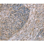 Immunohistochemistry - SCN1B Antibody from Signalway Antibody (37898) - Antibodies.com