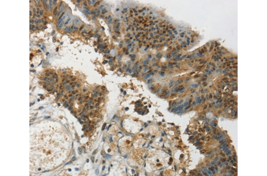 Immunohistochemistry - SYCP1 Antibody from Signalway Antibody (37899) - Antibodies.com