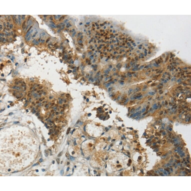 Immunohistochemistry - SYCP1 Antibody from Signalway Antibody (37899) - Antibodies.com