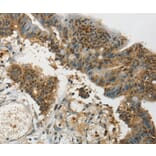 Immunohistochemistry - SYCP1 Antibody from Signalway Antibody (37899) - Antibodies.com