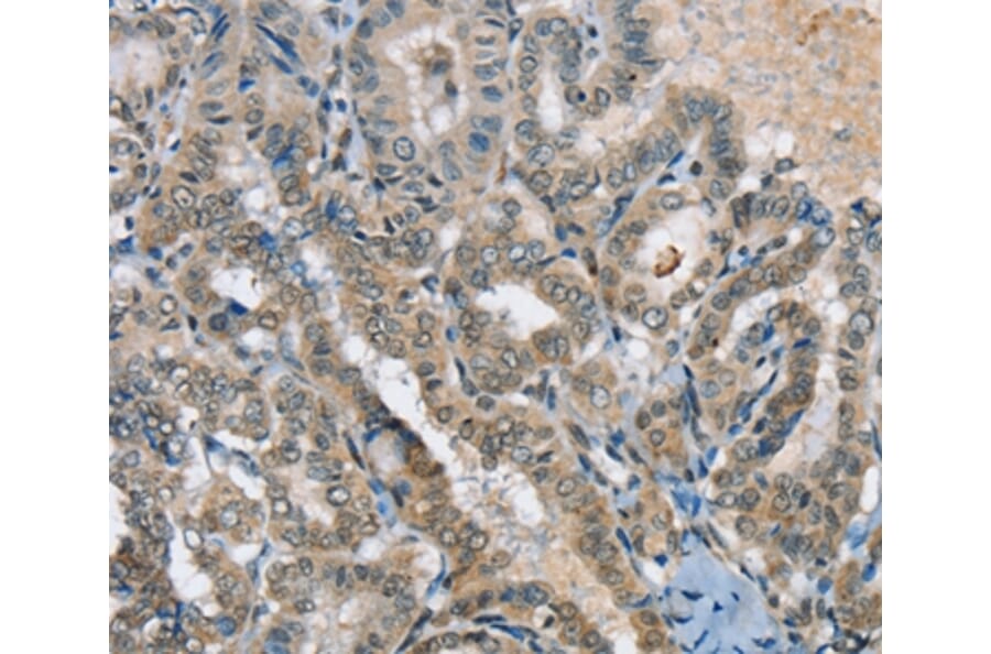 Immunohistochemistry - SEPN1 Antibody from Signalway Antibody (37905) - Antibodies.com