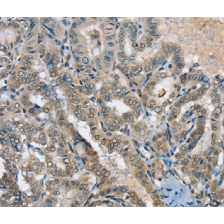 Immunohistochemistry - SEPN1 Antibody from Signalway Antibody (37905) - Antibodies.com