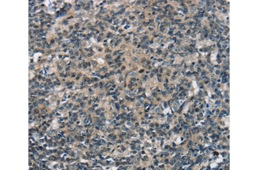 Immunohistochemistry - SEPN1 Antibody from Signalway Antibody (37905) - Antibodies.com