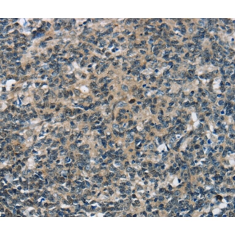 Immunohistochemistry - SEPN1 Antibody from Signalway Antibody (37905) - Antibodies.com