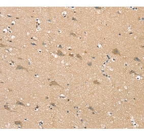 Immunohistochemistry - SGPL1 Antibody from Signalway Antibody (37919) - Antibodies.com