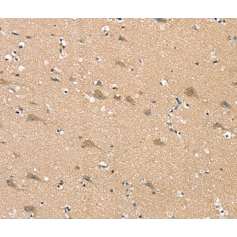 Immunohistochemistry - SGPL1 Antibody from Signalway Antibody (37919) - Antibodies.com
