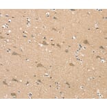 Immunohistochemistry - SGPL1 Antibody from Signalway Antibody (37919) - Antibodies.com