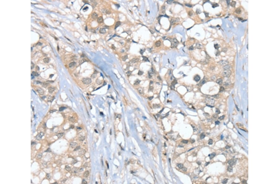 Immunohistochemistry - SGPL1 Antibody from Signalway Antibody (37919) - Antibodies.com