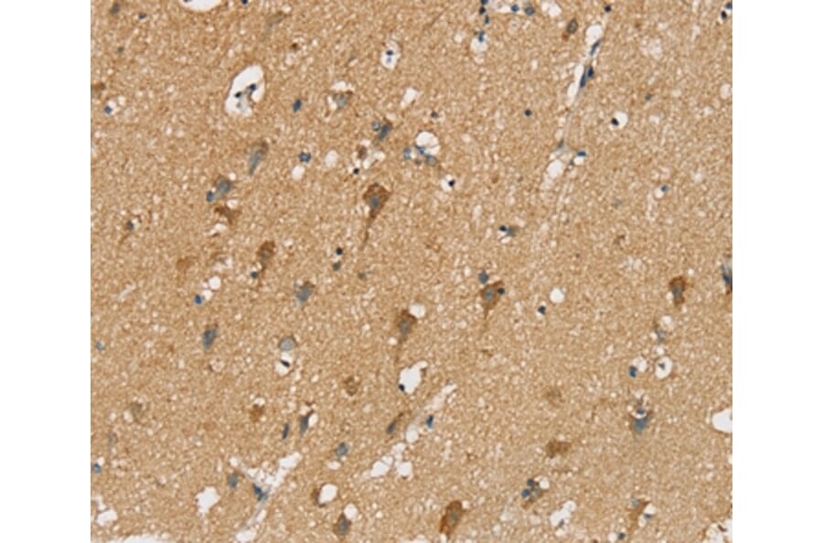 Immunohistochemistry - SIAH2 Antibody from Signalway Antibody (37920) - Antibodies.com