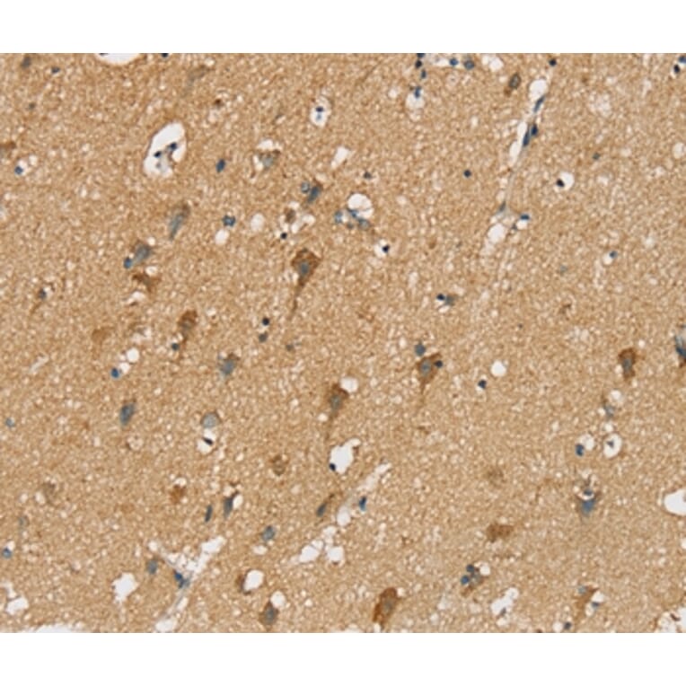 Immunohistochemistry - SIAH2 Antibody from Signalway Antibody (37920) - Antibodies.com