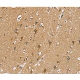 Immunohistochemistry - SIAH2 Antibody from Signalway Antibody (37920) - Antibodies.com