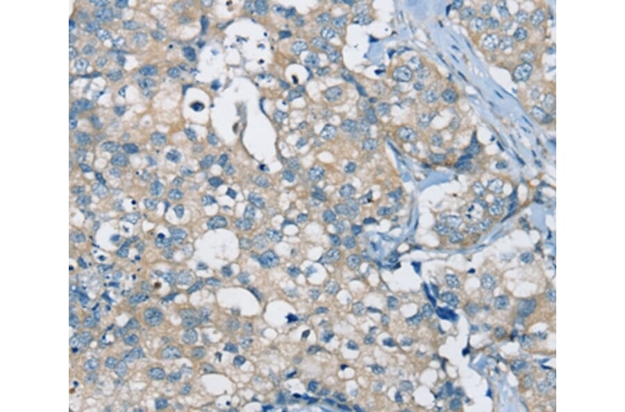 Immunohistochemistry - SIAH2 Antibody from Signalway Antibody (37920) - Antibodies.com