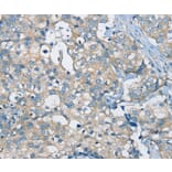 Immunohistochemistry - SIAH2 Antibody from Signalway Antibody (37920) - Antibodies.com