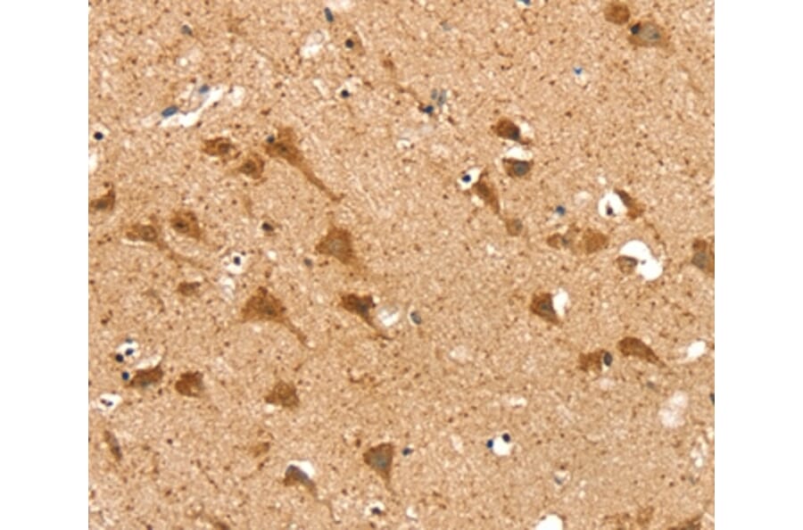 Immunohistochemistry - SRP68 Antibody from Signalway Antibody (37926) - Antibodies.com