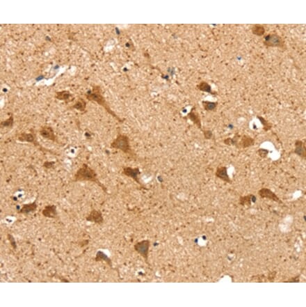 Immunohistochemistry - SRP68 Antibody from Signalway Antibody (37926) - Antibodies.com