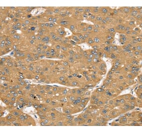 Immunohistochemistry - SLIT1 Antibody from Signalway Antibody (37950) - Antibodies.com