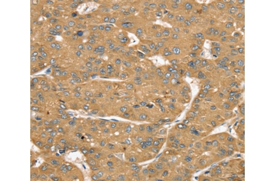 Immunohistochemistry - SLIT1 Antibody from Signalway Antibody (37950) - Antibodies.com