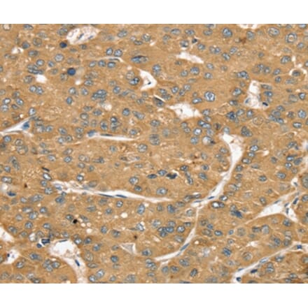Immunohistochemistry - SLIT1 Antibody from Signalway Antibody (37950) - Antibodies.com