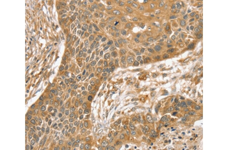 Immunohistochemistry - SLIT1 Antibody from Signalway Antibody (37950) - Antibodies.com