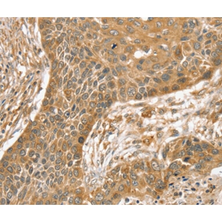 Immunohistochemistry - SLIT1 Antibody from Signalway Antibody (37950) - Antibodies.com