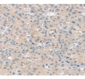 Immunohistochemistry - SLIT2 Antibody from Signalway Antibody (37951) - Antibodies.com