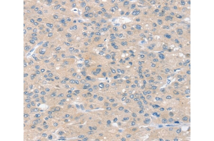 Immunohistochemistry - SLIT2 Antibody from Signalway Antibody (37951) - Antibodies.com