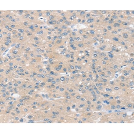 Immunohistochemistry - SLIT2 Antibody from Signalway Antibody (37951) - Antibodies.com