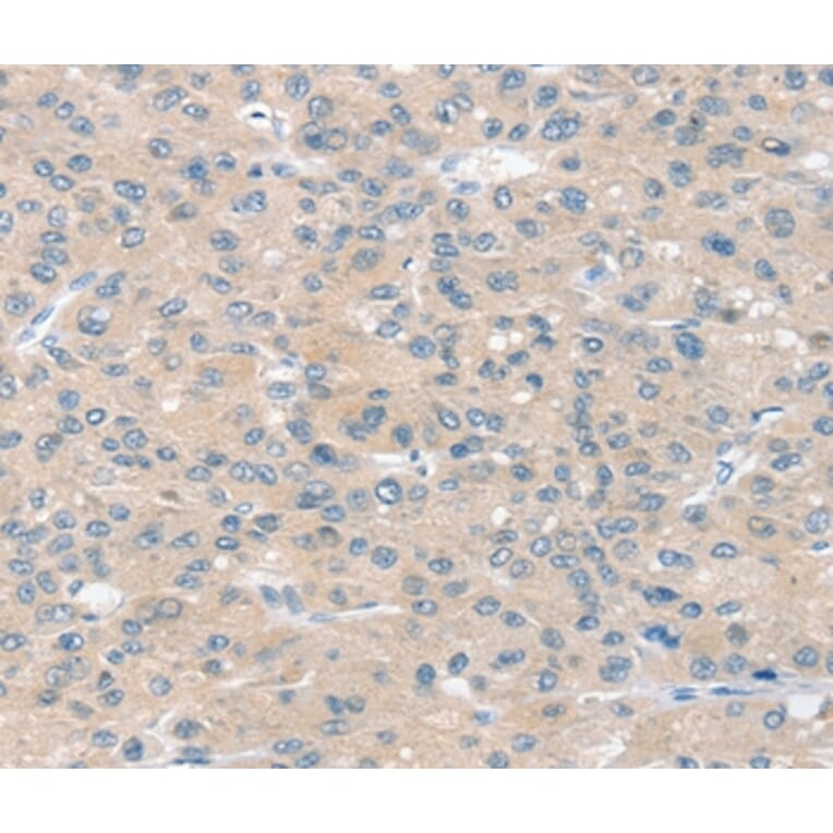 Immunohistochemistry - SLIT2 Antibody from Signalway Antibody (37951) - Antibodies.com