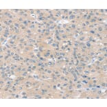Immunohistochemistry - SLIT2 Antibody from Signalway Antibody (37951) - Antibodies.com
