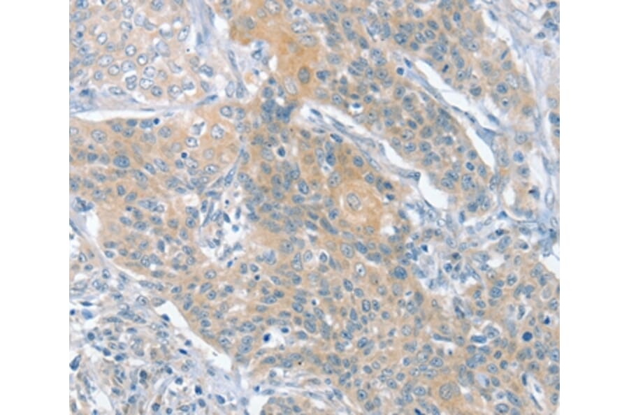 Immunohistochemistry - SLIT2 Antibody from Signalway Antibody (37951) - Antibodies.com