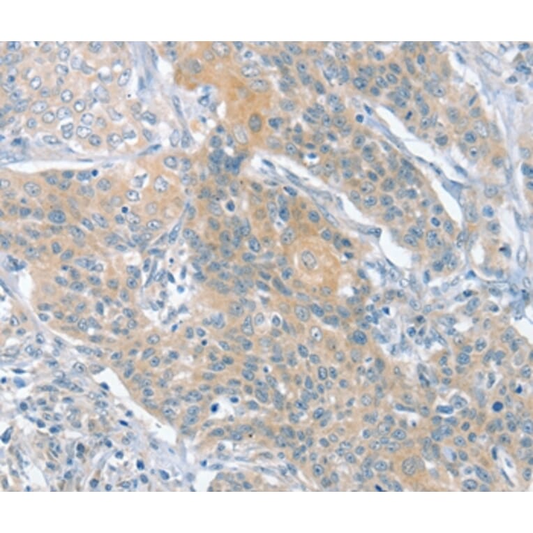 Immunohistochemistry - SLIT2 Antibody from Signalway Antibody (37951) - Antibodies.com